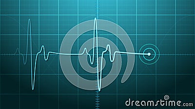 EKG - Electrocardiogram Stock Photo