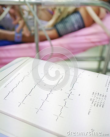A focus on an EKG machine printing a readout of vitals in a primary physicians office setting with blurred background. Stock Photo