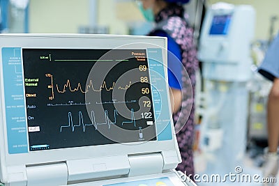 EKG monitor in intra aortic balloon pump machine. Stock Photo