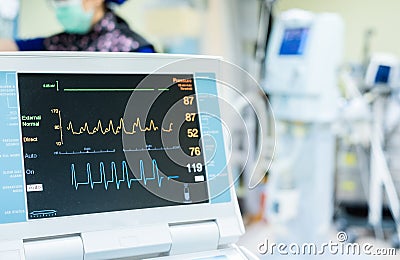 EKG monitor in intra aortic balloon pump machine. Stock Photo