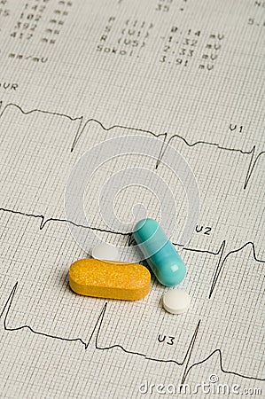 EKG printout Stock Photo