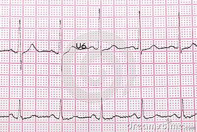 EKG printout Stock Photo