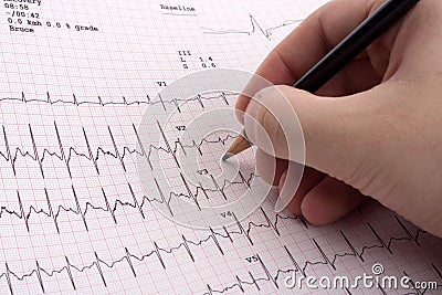 EKG results Stock Photo