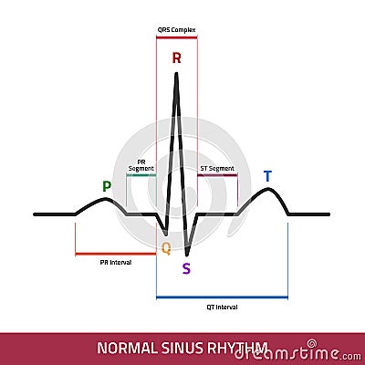 EKG showing normal heartbeat wave. ECG of Normal Sinus Rhythm infographic diagram Vector Illustration