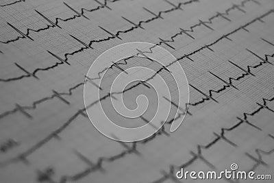 EKG von einem Kardiologen Stock Photo