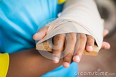 Child arm broken elastic round arm Stock Photo