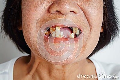 The elderly Asian woman smiled and saw the teeth remaining in the mouth. Stock Photo