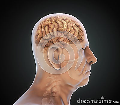 Elderly Male with Unhealthy Brain Stock Photo