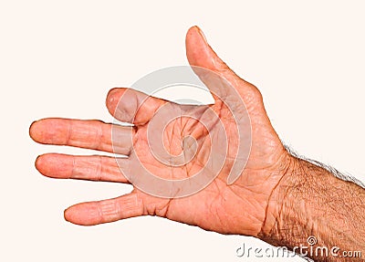 Elderly man hand with amputated finger Stock Photo