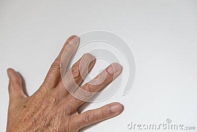 Elderly man right hand with amputated middle finger Stock Photo