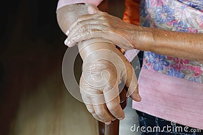 Elderly swollen hand or edema hand Stock Photo
