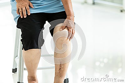 Elderly woman with chronic knee problems and leg pain holding her knee and massaging with hand,senior woman suffering from pain in Stock Photo