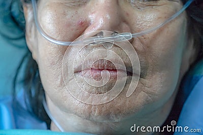 Elderly woman with nasal breathing tube Stock Photo