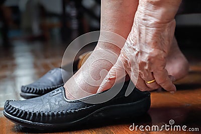 Elderly woman swollen feet putting on shoes Stock Photo