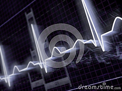 Electrocardiogram Stock Photo