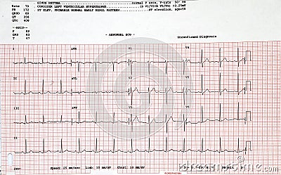 Electrocardiogram Stock Photo