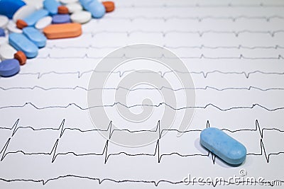 Electrocardiogram with Brugada syndrome. Colored pills on an EKG path. Sudden cardiac death due to arrhythmias Stock Photo
