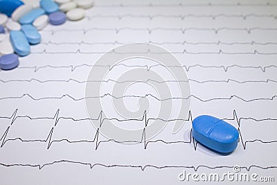 Electrocardiogram with Brugada syndrome. Colored pills on an EKG path. Sudden cardiac death due to arrhythmias Stock Photo