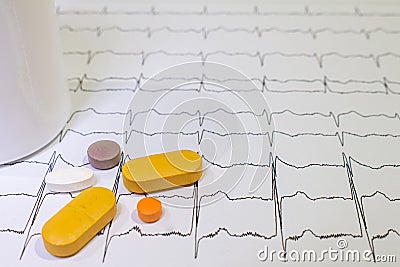Electrocardiogram with Brugada syndrome. Colored pills on an EKG path. Sudden cardiac death due to arrhythmias Stock Photo