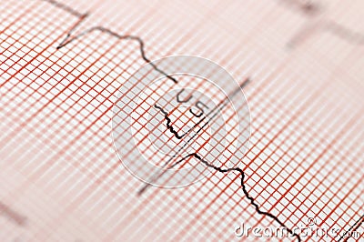 Electrocardiogram in close up Stock Photo