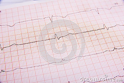 Electrocardiogram close-up Stock Photo