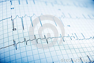 Electrocardiogram Stock Photo