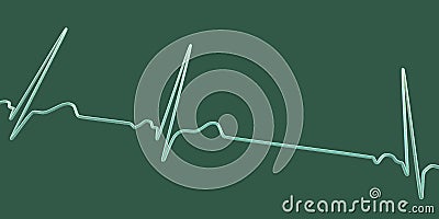 Electrocardiogram ECG displaying sinus arrhythmia, 3D illustration Cartoon Illustration