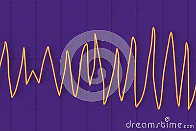 Electrocardiogram ECG displaying Torsades de pointes rhythm, 3D illustration Cartoon Illustration