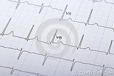 Electrocardiogram Stock Photo