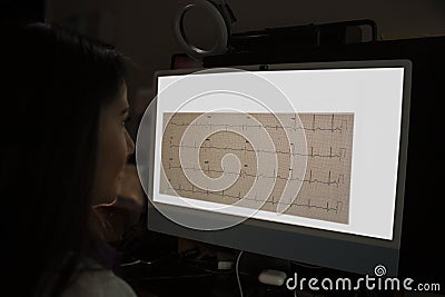 Electrocardiogram shows incomplete right bundle branch block analyzed by Caucasian cardiologist on the computer diagnostic Stock Photo