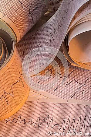 Electrocardiograph Test Results - Cardiac Arrhythmia Stock Photo