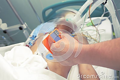 Electrodes for cardioversion in the hands of the doctor-intensivists are ready to apply. Stock Photo