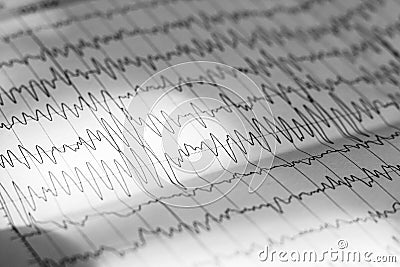 Electroencephalogram result on paper closeup, brain activity test Stock Photo