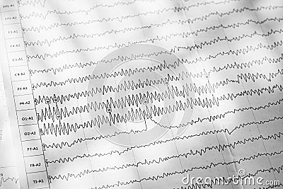 Electroencephalogram result on paper closeup, brain activity test Stock Photo