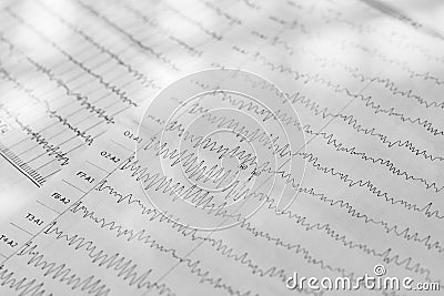 Electroencephalogram result on paper closeup, brain activity test Stock Photo