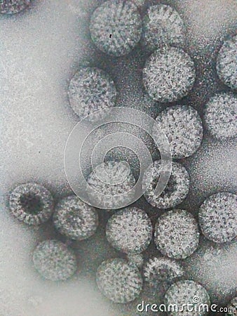 Electron microscopy of rotavirus particles Stock Photo