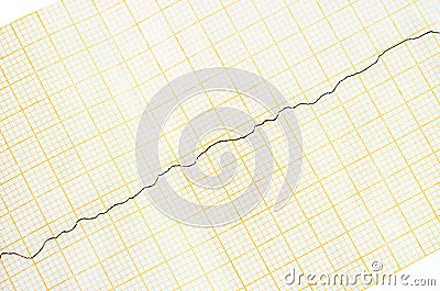 ECG tape with ventricular fibrillation Stock Photo