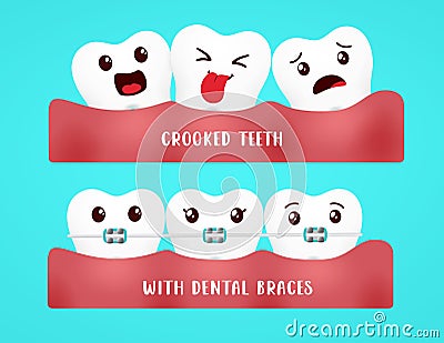 Emoji dental braces vector design. Emojis tooth with dental brace and crooked teeth character for clean and healthy oral health. Vector Illustration