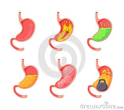 Empty and full stomach. Bloating stomach ache, gerd digestive tract pain fullness heaviness stomaches, acid heartburn Vector Illustration