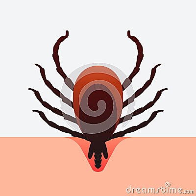 Encephalitis mite bites through human skin Vector Illustration