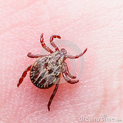 Encephalitis Virus or Lyme Borreliosis Disease Infected Tick Arachnid Insect Crawling on Skin Stock Photo