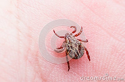 Encephalitis Virus or Lyme Disease Infected Tick Arachnid Insect on Skin Stock Photo