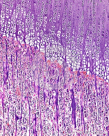 Endochondral ossification. Growth plate Stock Photo