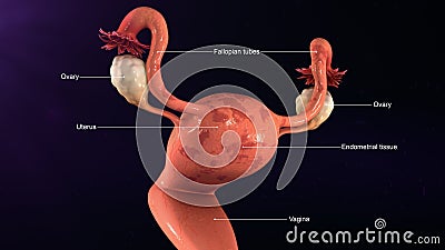 Endometriosis Stock Photo