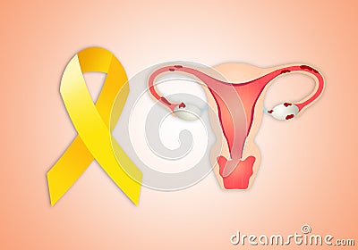 Endometriosis Stock Photo