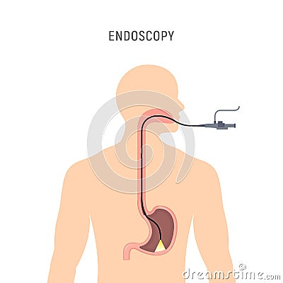 Endoscopy stomach anatomy equipment vector illustration. Esophagus endoscope body exam, gastroscopy human instrument Cartoon Illustration