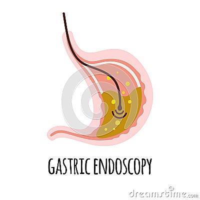 Endoscopy. The stomach of a person with high acidity. Gastroenterology. Vector illustration in a flat style. Vector Illustration