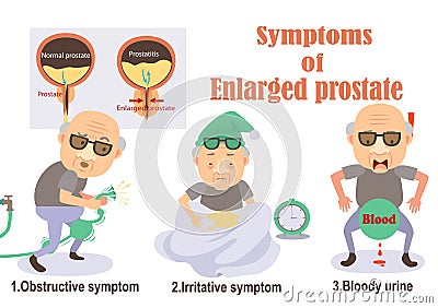 Enlarged prostate Vector Illustration