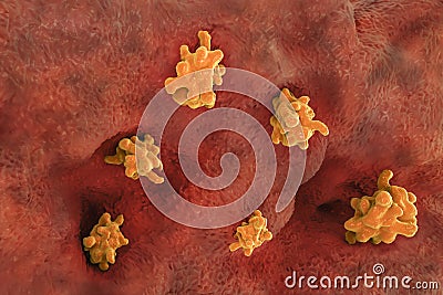 Entamoeba histolytica invading intestine Cartoon Illustration