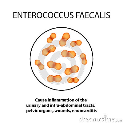 Enterococcus faecalis. Pathogenic flora. The bacterium causes intestinal diseases. Infographics. Vector illustration. Vector Illustration